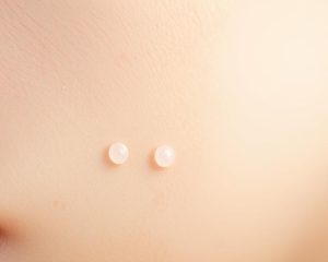 Zaskórniki zamknięte – przyczyny, pielęgnacja i skuteczne metody działania